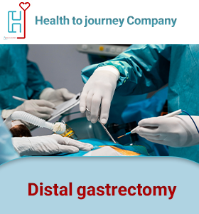 Distal gastrectomy