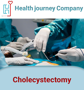 Cholecystectomy