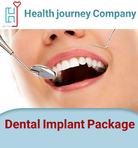 Dental Implant Package