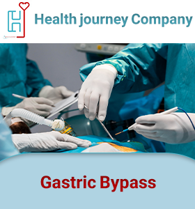 Gastric Bypass