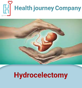 Hydrocelectomy