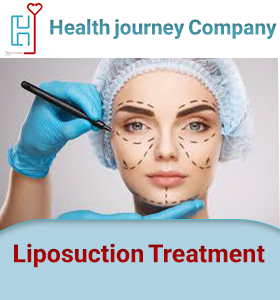 Liposuction Treatment