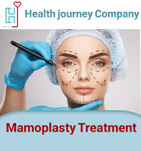 Mamoplasty Treatment