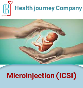 Microinjection (ICSI)