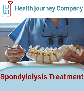 Spondylolysis Treatment