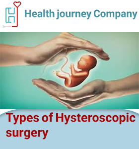 Types of Hysteroscopic surgery